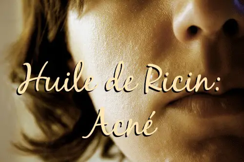 Huile de ricin acné - Huile de Ricin Huile de ricin acné - Huile de Ricin