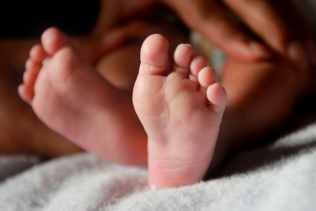 huile de ricin bébé, le produit idéal